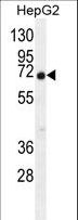 C11orf95 Antibody - C9JLR9 Antibody western blot of HepG2 cell line lysates (35 ug/lane). The C9JLR9 antibody detected the C9JLR9 protein (arrow).