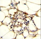 C11orf95 Antibody - C9JLR9 Antibody immunohistochemistry of formalin-fixed and paraffin-embedded human adipose tissue followed by peroxidase-conjugated secondary antibody and DAB staining.
