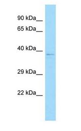 C12orf10 Antibody - C12orf10 antibody Western Blot of MCF7.  This image was taken for the unconjugated form of this product. Other forms have not been tested.