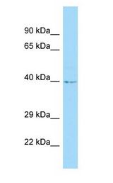 C12orf10 Antibody - C12orf10 antibody Western Blot of 293T.  This image was taken for the unconjugated form of this product. Other forms have not been tested.