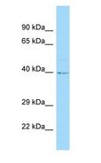 C12orf10 Antibody - C12orf10 antibody Western Blot of 293T.  This image was taken for the unconjugated form of this product. Other forms have not been tested.