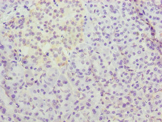 C12orf26 Antibody - Immunohistochemistry of paraffin-embedded human pancreatic tissue using METTL25 Antibody at dilution of 1:100