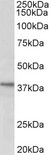 C12orf29 Antibody - C12orf29 antibody (1 ug/ml) staining of HeLa lysate (35 ug protein in RIPA buffer). Primary incubation was 1 hour. Detected by chemiluminescence.
