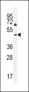 C12orf29 Antibody - CL029 Antibody western blot of NCI-H460 cell line lysates (35 ug/lane). The CL029 antibody detected the CL029 protein (arrow).