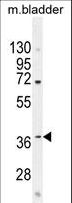 C12orf29 Antibody - CL029 Antibody western blot of mouse bladder tissue lysates (35 ug/lane). The CL029 antibody detected the CL029 protein (arrow).