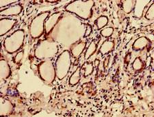 C12orf43 Antibody - Immunohistochemistry of paraffin-embedded human thyroid tissue using C12orf43 Antibody at dilution of 1:100