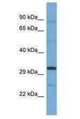 C12orf49 Antibody - C12orf49 antibody Western Blot of ACHN. Antibody dilution: 1 ug/ml.  This image was taken for the unconjugated form of this product. Other forms have not been tested.