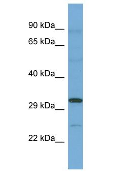 C12orf49 Antibody - C12orf49 antibody Western Blot of ACHN. Antibody dilution: 1 ug/ml.  This image was taken for the unconjugated form of this product. Other forms have not been tested.