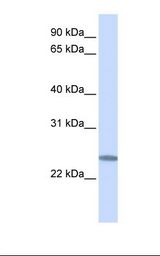 C12orf49 Antibody - Hela cell lysate. Antibody concentration: 1.0 ug/ml. Gel concentration: 12%.  This image was taken for the unconjugated form of this product. Other forms have not been tested.