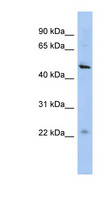 C12orf50 Antibody - C12orf50 antibody Western blot of HepG2 cell lysate. This image was taken for the unconjugated form of this product. Other forms have not been tested.