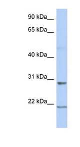 C12orf53 Antibody - C12orf53 antibody Western blot of Fetal Spleen lysate. This image was taken for the unconjugated form of this product. Other forms have not been tested.
