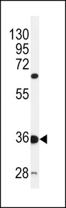 C12orf53 Antibody - Western blot of C12orf53 Antibody in mouse liver tissue lysates (35 ug/lane). C12orf53 (arrow) was detected using the purified antibody.