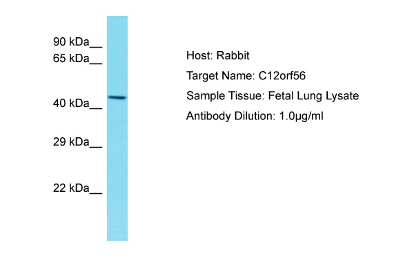 C12orf56 Antibody -  This image was taken for the unconjugated form of this product. Other forms have not been tested.