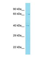 C12orf56 Antibody - Western blot of C12orf56 Antibody - N-terminal region with human MDA-MB-435S cells lysate.  This image was taken for the unconjugated form of this product. Other forms have not been tested.