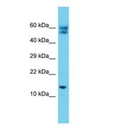 C12orf65 Antibody - Western blot of C12orf65 Antibody - C-terminal region with human Jurkat cells lysate.  This image was taken for the unconjugated form of this product. Other forms have not been tested.