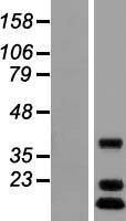 C12orf65 Protein - Western validation with an anti-DDK antibody * L: Control HEK293 lysate R: Over-expression lysate