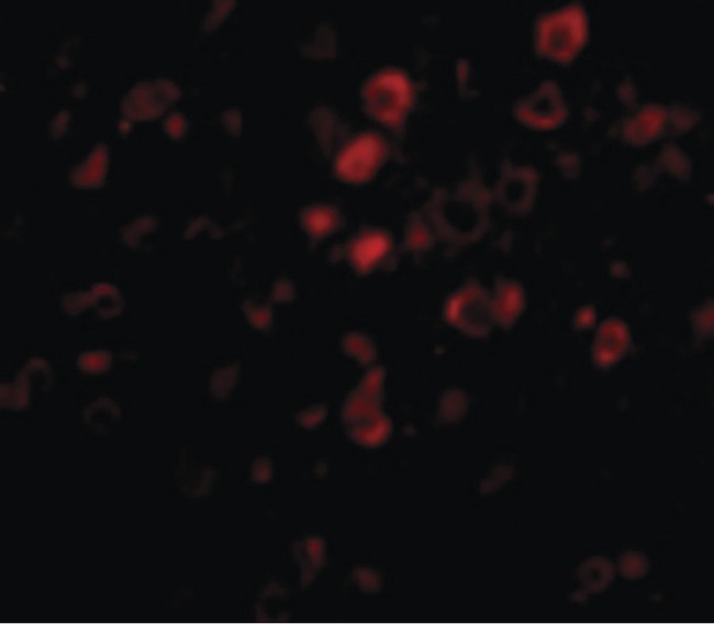 C13orf34 / BORA Antibody - Immunofluorescence of Bora in Mouse Brain cells with Bora antibody at 20 ug/ml.