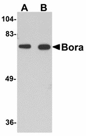C13orf34 / BORA Antibody - Western blot of Bora in mouse brain tissue lysate with Bora antibody at (A) 1 and (B) 2 ug/ml. Below: Immunohistochemistry of Bora in mouse brain tissue with Bora antibody at 2.5 ug/ml.