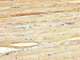 C13orf34 / BORA Antibody - Immunohistochemistry image at a dilution of 1:300 and staining in paraffin-embedded human skeletal muscle tissue performed on a Leica BondTM system. After dewaxing and hydration, antigen retrieval was mediated by high pressure in a citrate buffer (pH 6.0) . Section was blocked with 10% normal goat serum 30min at RT. Then primary antibody (1% BSA) was incubated at 4 °C overnight. The primary is detected by a biotinylated secondary antibody and visualized using an HRP conjugated SP system.