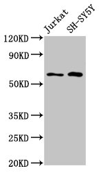 C13orf34 / BORA Antibody - Positive Western Blot detected in Jurkat whole cell lysate, SH-SY5Y whole cell lysate. All lanes: BORA antibody at 4.8 µg/ml Secondary Goat polyclonal to rabbit IgG at 1/50000 dilution. Predicted band size: 62, 54 KDa. Observed band size: 62 KDa