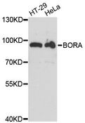 C13orf34 / BORA Antibody - Western blot analysis of extracts of various cell lines, using BORA antibody at 1:3000 dilution. The secondary antibody used was an HRP Goat Anti-Rabbit IgG (H+L) at 1:10000 dilution. Lysates were loaded 25ug per lane and 3% nonfat dry milk in TBST was used for blocking. An ECL Kit was used for detection and the exposure time was 40s.