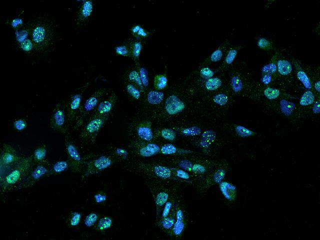C13orf34 / BORA Antibody - Immunofluorescence staining of BORA in U251MG cells. Cells were fixed with 4% PFA, permeabilzed with 0.1% Triton X-100 in PBS, blocked with 10% serum, and incubated with rabbit anti-Human BORA polyclonal antibody (dilution ratio 1:200) at 4°C overnight. Then cells were stained with the Alexa Fluor 488-conjugated Goat Anti-rabbit IgG secondary antibody (green) and counterstained with DAPI (blue). Positive staining was localized to Nucleus.