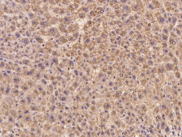 C13orf34 / BORA Antibody - Immunochemical staining of human BORA in human liver with rabbit polyclonal antibody at 1:100 dilution, formalin-fixed paraffin embedded sections.