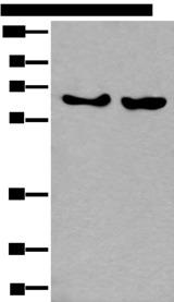 C13orf34 / BORA Antibody - Western blot analysis of K562 and Hela cell lysates  using BORA Polyclonal Antibody at dilution of 1:800