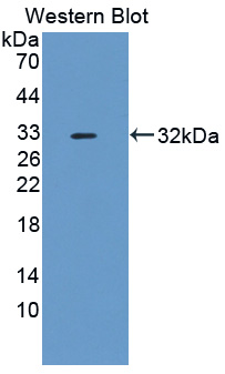 C13orf39 Antibody - Western blot of C13orf39 antibody.