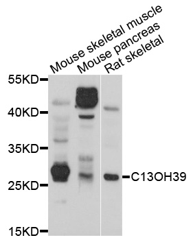 C13orf39 Antibody - Western blot analysis of extracts of various cell lines, using METTL21C antibody at 1:1000 dilution. The secondary antibody used was an HRP Goat Anti-Rabbit IgG (H+L) at 1:10000 dilution. Lysates were loaded 25ug per lane and 3% nonfat dry milk in TBST was used for blocking. An ECL Kit was used for detection and the exposure time was 10s.