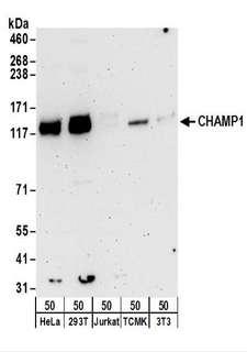 C13orf8 / ZNF828 Antibody - Detection of Human and Mouse CHAMP1 by Western Blot. Samples: Whole cell lysate (50 ug) from HeLa, 293T, Jurkat, mouse TCMK-1, and mouse NIH3T3 cells. Antibodies: Affinity purified rabbit anti-CHAMP1 antibody used for WB at 0.1 ug/ml. Detection: Chemiluminescence with an exposure time of 3 minutes.