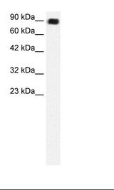 C13orf8 / ZNF828 Antibody - Daudi Cell Lysate.  This image was taken for the unconjugated form of this product. Other forms have not been tested.
