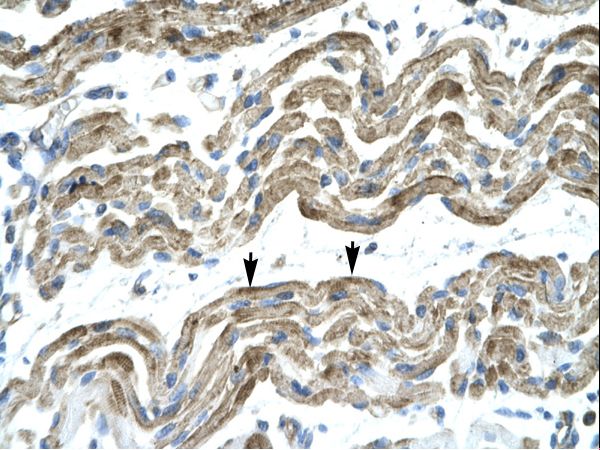 C13orf8 / ZNF828 Antibody - ZNF828 / C13orf8 antibody ARP31889_T100-NP_115812-C13ORF8 Antibody was used in IHC to stain formalin-fixed, paraffin-embedded human muscle.  This image was taken for the unconjugated form of this product. Other forms have not been tested.
