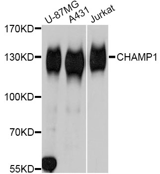 C13orf8 / ZNF828 Antibody - Western blot analysis of extracts of various cell lines, using CHAMP1 Antibody at 1:3000 dilution. The secondary antibody used was an HRP Goat Anti-Rabbit IgG (H+L) at 1:10000 dilution. Lysates were loaded 25ug per lane and 3% nonfat dry milk in TBST was used for blocking. An ECL Kit was used for detection and the exposure time was 1s.