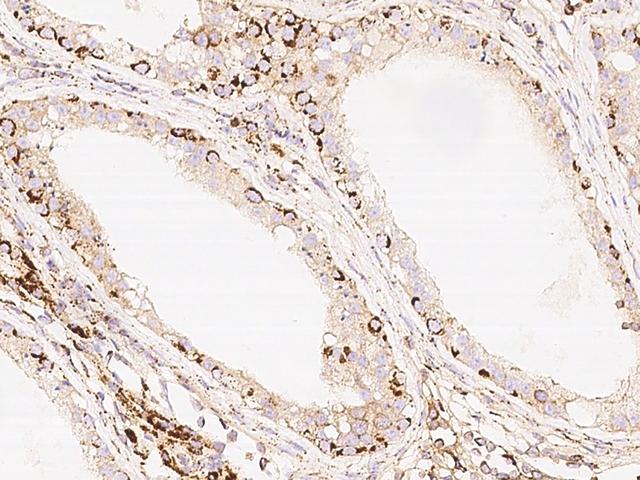 C14orf104 Antibody - Immunochemical staining of human DNAAF2 in human testis with rabbit polyclonal antibody at 1:300 dilution, formalin-fixed paraffin embedded sections.