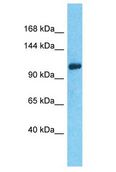 C14orf106 Antibody - C14orf106 antibody Western Blot of 293T. Antibody dilution: 1 ug/ml.  This image was taken for the unconjugated form of this product. Other forms have not been tested.