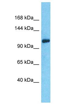 C14orf106 Antibody - C14orf106 antibody Western Blot of 293T. Antibody dilution: 1 ug/ml.  This image was taken for the unconjugated form of this product. Other forms have not been tested.