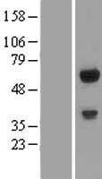 C14orf118 Protein - Western validation with an anti-DDK antibody * L: Control HEK293 lysate R: Over-expression lysate