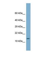 C14orf119 Antibody - Western blot of Human Fetal Kidney. C14orf119 antibody dilution 1.0 ug/ml.  This image was taken for the unconjugated form of this product. Other forms have not been tested.