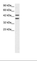 C14orf131 / ZNF839 Antibody - HepG2 Cell Lysate.  This image was taken for the unconjugated form of this product. Other forms have not been tested.