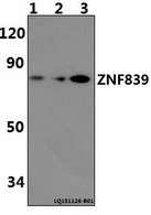 C14orf131 / ZNF839 Antibody - Western blot of ZNF839 polyclonal antibody at 1:500 dilution. Lane 1: H9C2 whole cell lysate (40 ug). Lane 2: RAW264.7 whole cell lysate(40 ug). Lane 3: HeLa whole cell lysate (40 ug).