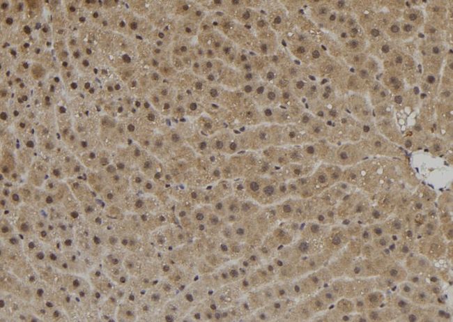 C14orf131 / ZNF839 Antibody - 1:100 staining rat liver tissue by IHC-P. The sample was formaldehyde fixed and a heat mediated antigen retrieval step in citrate buffer was performed. The sample was then blocked and incubated with the antibody for 1.5 hours at 22°C. An HRP conjugated goat anti-rabbit antibody was used as the secondary.