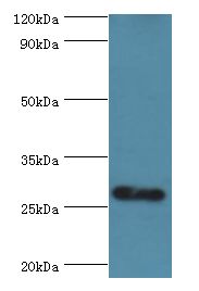 C14orf166 Antibody - Western blot. All lanes: C14orf166 antibody at 6 ug/ml+mouse lung tissue. Secondary antibody: Goat polyclonal to rabbit at 1:10000 dilution. Predicted band size: 28 kDa. Observed band size: 28 kDa.