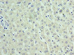C14orf166 Antibody - Immunohistochemistry of paraffin-embedded human liver using antibody at 1:100 dilution.