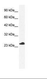 C14orf166 Antibody - Jurkat Cell Lysate.  This image was taken for the unconjugated form of this product. Other forms have not been tested.