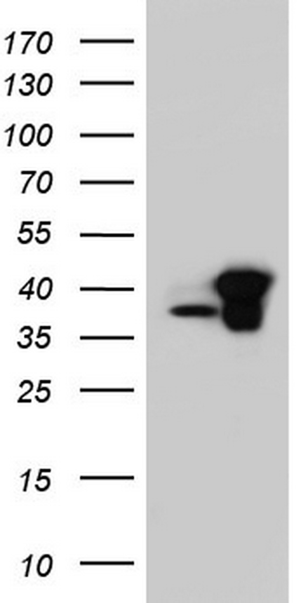C14orf166 Antibody - HEK293T cells were transfected with the pCMV6-ENTRY control (Left lane) or pCMV6-ENTRY C14orf166 (Right lane) cDNA for 48 hrs and lysed. Equivalent amounts of cell lysates (5 ug per lane) were separated by SDS-PAGE and immunoblotted with anti-C14orf166.