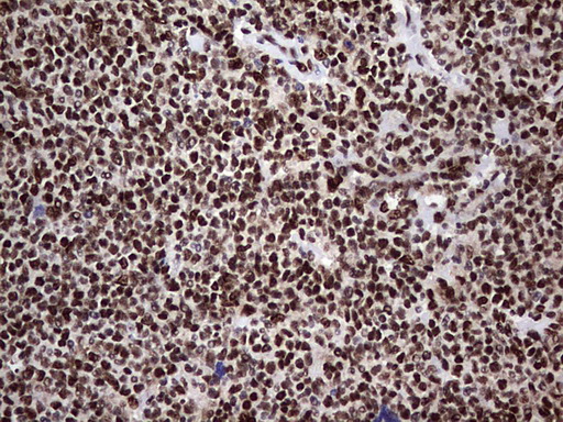 C14orf166 Antibody - IHC of paraffin-embedded Human lymphoma tissue using anti-C14orf166 mouse monoclonal antibody. (Heat-induced epitope retrieval by 1 mM EDTA in 10mM Tris, pH8.5, 120°C for 3min).