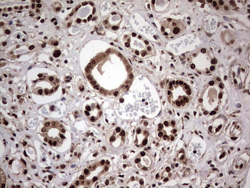 C14orf166 Antibody - IHC of paraffin-embedded Human Kidney tissue using anti-C14orf166 mouse monoclonal antibody. (Heat-induced epitope retrieval by 1 mM EDTA in 10mM Tris, pH8.5, 120°C for 3min).