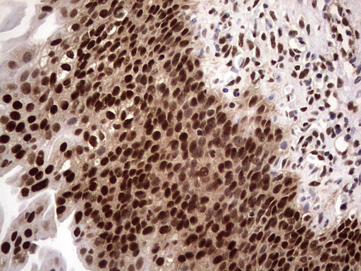 C14orf166 Antibody - IHC of paraffin-embedded Human bladder tissue using anti-C14orf166 mouse monoclonal antibody. (Heat-induced epitope retrieval by 1 mM EDTA in 10mM Tris, pH8.5, 120°C for 3min).