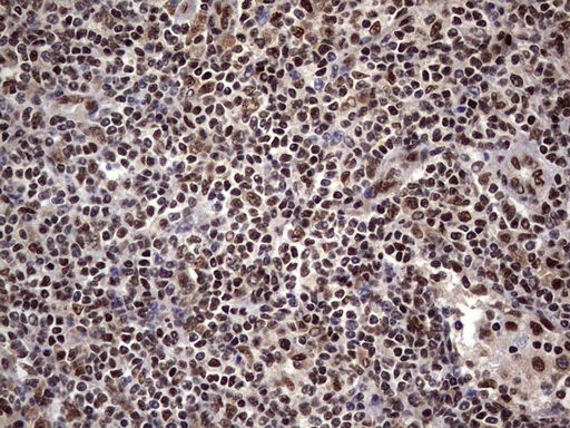 C14orf166 Antibody - IHC of paraffin-embedded Human lymph node tissue using anti-C14orf166 mouse monoclonal antibody. (Heat-induced epitope retrieval by 1 mM EDTA in 10mM Tris, pH8.5, 120°C for 3min).